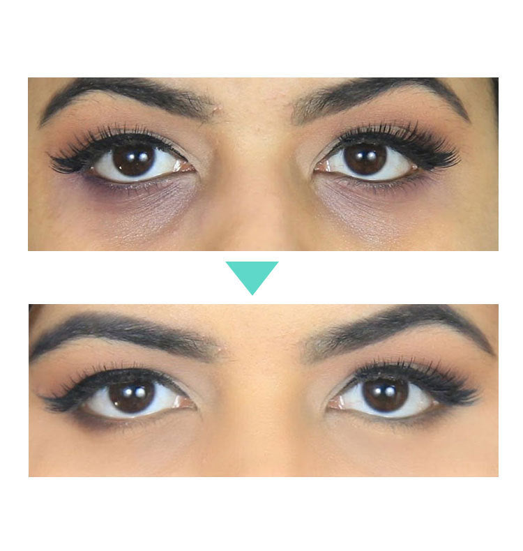 Beauty Eye Cream – Brighten, Firm & Reduce Dark Circles