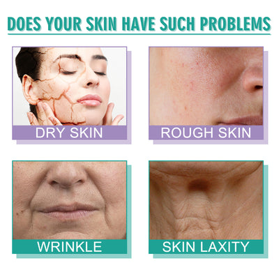 Hoygi Moisturizing Skin Care Cream