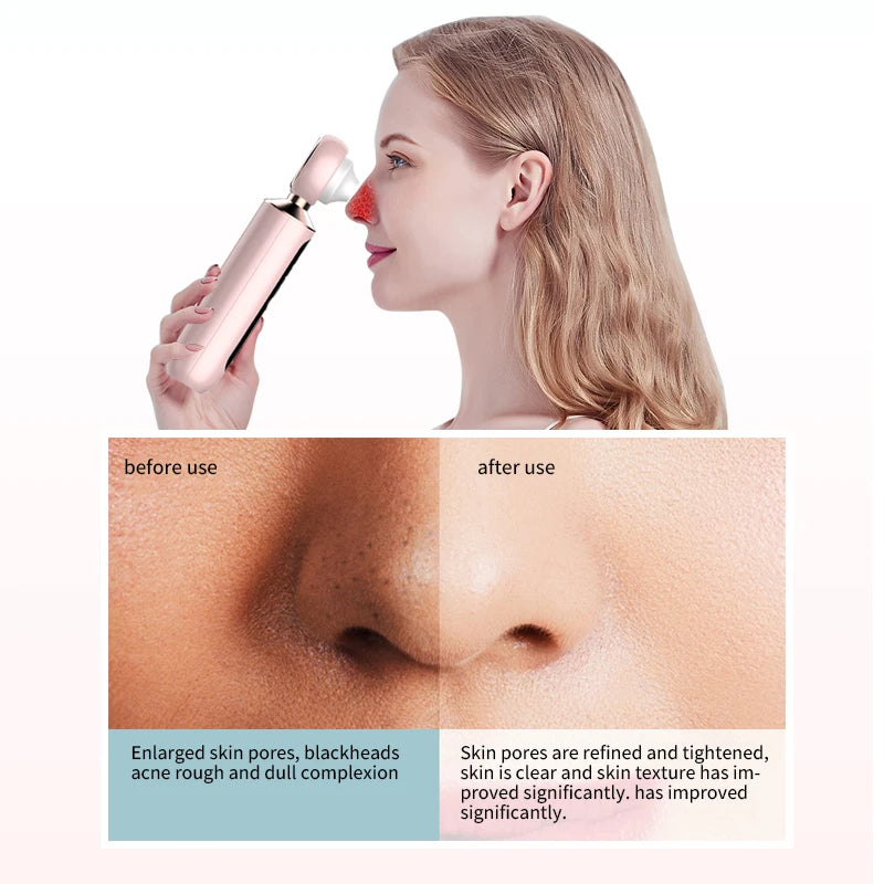 facial blackhead remover