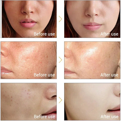 Ultrasonic Face Cleaner